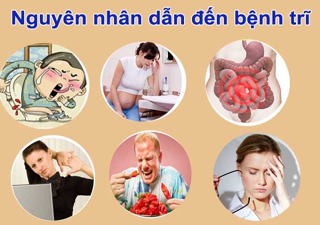 Một số nguyên nhân phổ biến dẫn đến bệnh trĩ