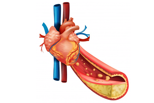 Uống nước lọc giảm cân